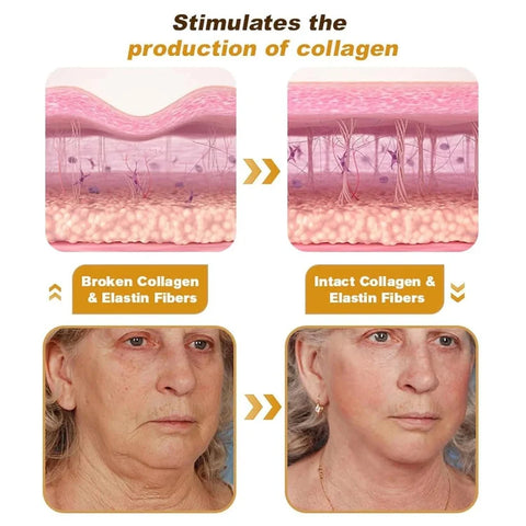 Botox Bee Venom Wrinkle Repair Cream